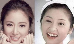 牙医爆料明星整牙视频大全,牙医爆料视频大全